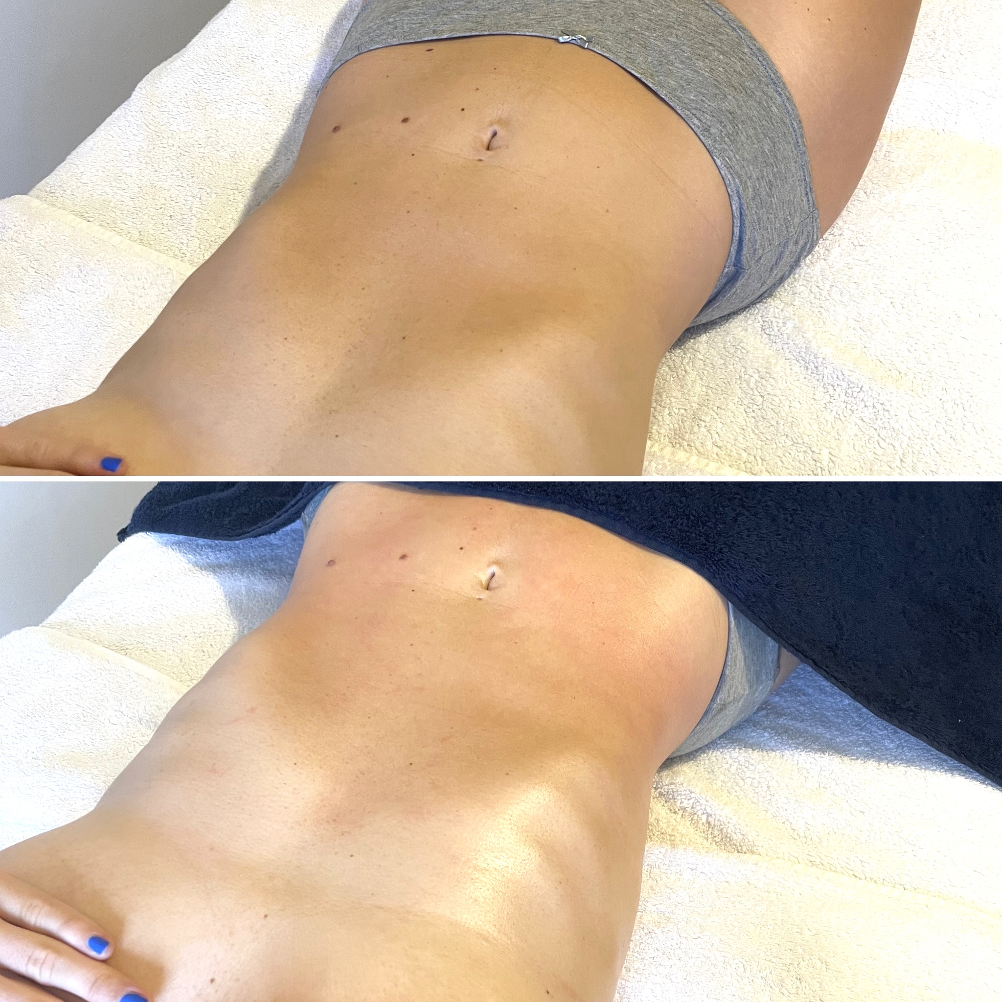 Le remodelage méthode Renata França, une exclusivité à Rennes chez Anavrin